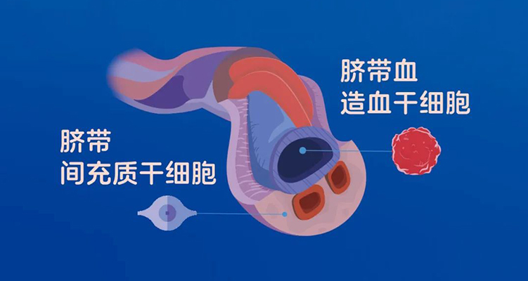 脐带血存储的意义与纳入医保的必要性