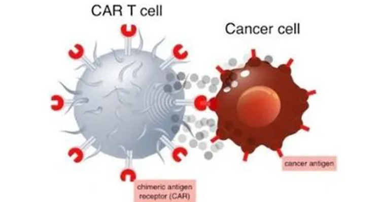 非病毒CAR-T细胞疗法：癌症治疗的“无病毒”革命？